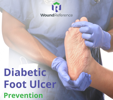DFU prevention diabetic foot