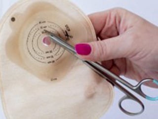 Ostomy_appliance change Sec Article