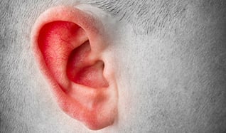 Sensorineural Hearing Loss