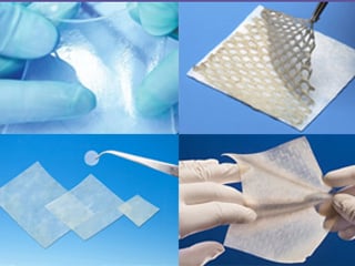 Skin Substitutes_secondary article