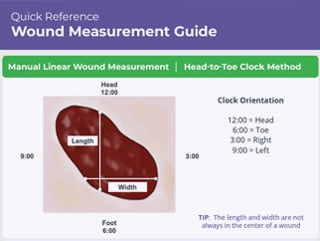 wound measurement guide
